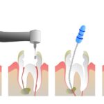 arthra-arth3-img-1-b